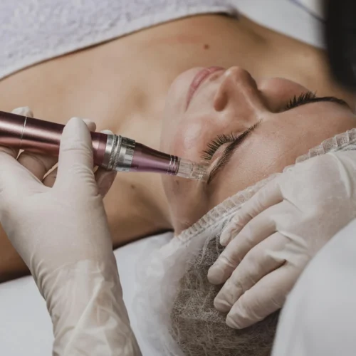 Microneedling and At-Home Aesthetic Devices: Professional Salons Give Way to Home Self-Care